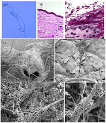 Attēlu rezultāti vaicājumam “Dianema depressum spores”