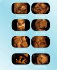 Baby Ultrasound, Baby Scanning, 3D Scans, 3D Ultrasound Scan ...