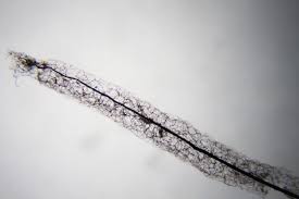 Attēlu rezultāti vaicājumam “Stemonaria irregularis spores”