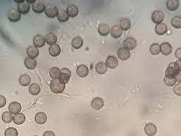 Attēlu rezultāti vaicājumam “Physarum virescens”