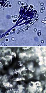 Attēlu rezultāti vaicājumam “Penicillium vulpinum”