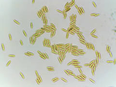 Attēlu rezultāti vaicājumam “Hyalorbilia inflatula”