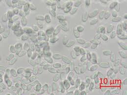 Attēlu rezultāti vaicājumam “Mycoacia fuscoatra”