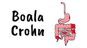 Image result for boala crohn si schizofrenie paranoida