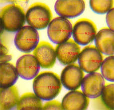 Attēlu rezultāti vaicājumam “Lycogala ustulatum sessile”
