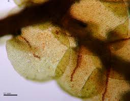 Attēlu rezultāti vaicājumam “Frullania tamarisci macro”