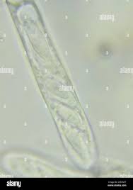 Attēlu rezultāti vaicājumam “Cudoniella acicularis”