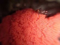 Attēlu rezultāti vaicājumam “Tubifera ferruginosa subsp. acutissima”