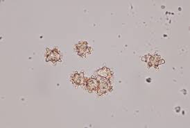 Attēlu rezultāti vaicājumam “Asterophora lycoperdoides”