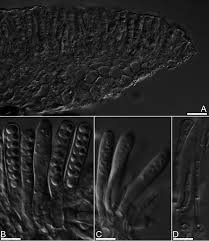 Attēlu rezultāti vaicājumam “Hyalorbilia inflatula”