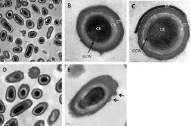 Attēlu rezultāti vaicājumam “Enteridium variabile spores”