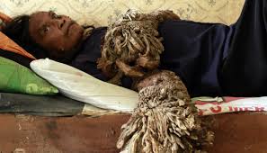 Image result for Lewandowsky-Lutz