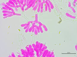 Attēlu rezultāti vaicājumam “Athelia pyriformis”