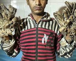 Image result for Lewandowsky-Lutz