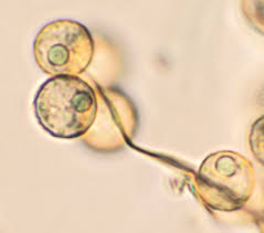 Attēlu rezultāti vaicājumam “Cribraria aurantiaca var. persoonii”