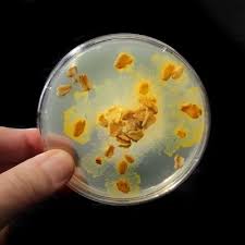 Attēlu rezultāti vaicājumam “Didymium tussilaginis spores”