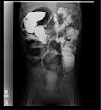Science Direct.com - Seminars in Pediatric Surgery - Clinical ... 