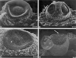Attēlu rezultāti vaicājumam “Trichia crateriformis stalked”