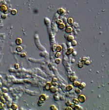 Attēlu rezultāti vaicājumam “Chaenotheca trichialis”