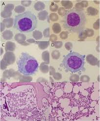 Attēlu rezultāti vaicājumam “Bryum funkii cells”