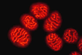 Attēlu rezultāti vaicājumam “Nostoc pruniforme cells”