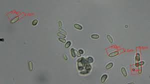 Attēlu rezultāti vaicājumam “Comatricha pulchella spores”