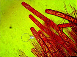 Attēlu rezultāti vaicājumam “Sarcoscypha austriaca var. lutea”