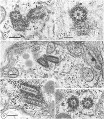 Attēlu rezultāti vaicājumam “Aulacomnium palustre”