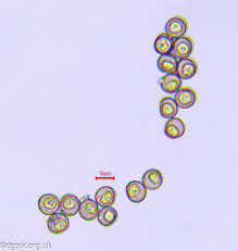 Attēlu rezultāti vaicājumam “Metatrichia floriformis spores”
