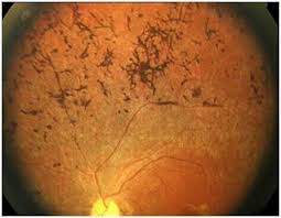 Attēlu rezultāti vaicājumam “Reticularia sp.”