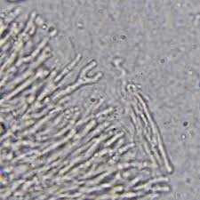 Attēlu rezultāti vaicājumam “Calocera cornea”