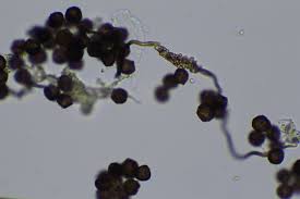 Attēlu rezultāti vaicājumam “Diderma subviridifuscum”