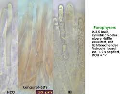 Attēlu rezultāti vaicājumam “Mollisia amenticola”