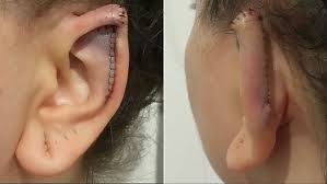 Image result for ear mod