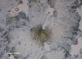 Attēlu rezultāti vaicājumam “Thelotrema lepadinum”