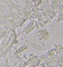 Attēlu rezultāti vaicājumam “Micarea sp.”
