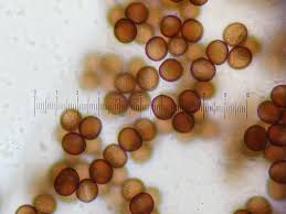 Attēlu rezultāti vaicājumam “Badhamia foliicola”