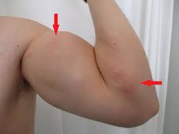 Image result for SYNTHOL