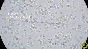 Attēlu rezultāti vaicājumam “Leucogyrophana mollusca”