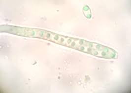 Attēlu rezultāti vaicājumam “Ionomidotis irregularis”