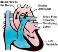 <b>Ductus Arteriosus</b>