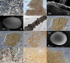 Attēlu rezultāti vaicājumam “Amaurochaete atra spores”