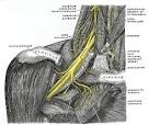 Lesione Del <b>Plesso Brachiale</b>