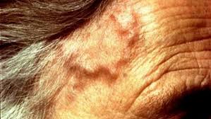 Image result for GCA