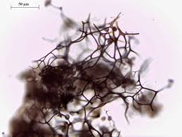 Attēlu rezultāti vaicājumam “Diachea leucopodia”