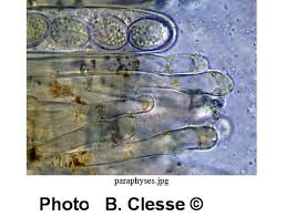 Attēlu rezultāti vaicājumam “Miladina lecithina”