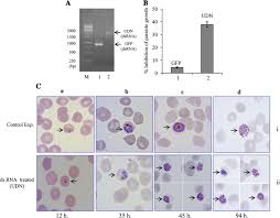Attēlu rezultāti vaicājumam “Dianema depressum plasmodium”