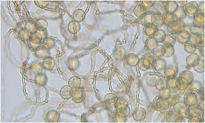 Attēlu rezultāti vaicājumam “Perichaena depressa”