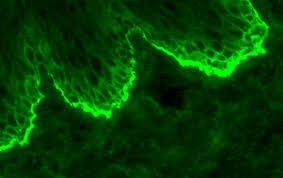 Attēlu rezultāti vaicājumam “Pemphigus borealis”