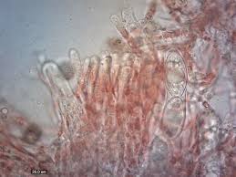 Attēlu rezultāti vaicājumam “Microstoma protracta”